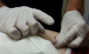 Close up needle tap