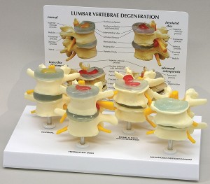 lumbar disc model